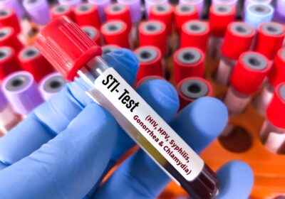 sti testing urgent care