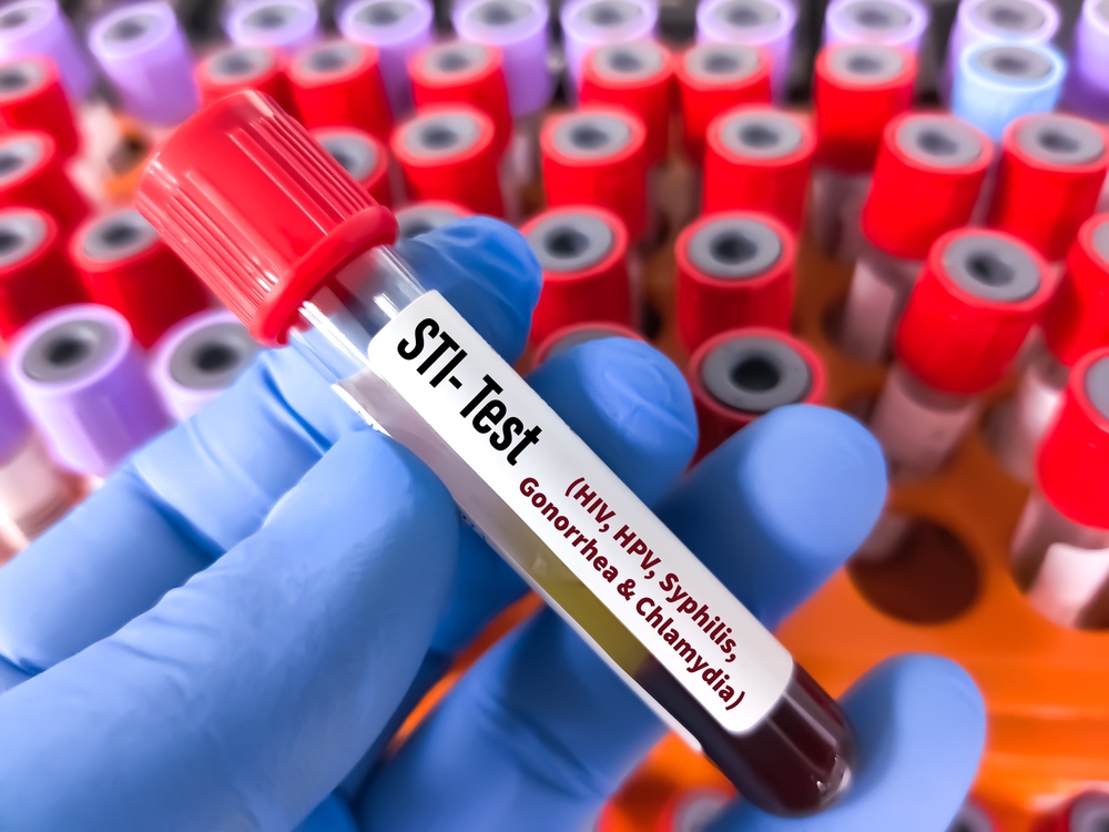 sti testing urgent care