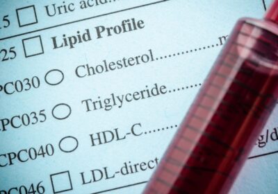 blood testing for cholesterol