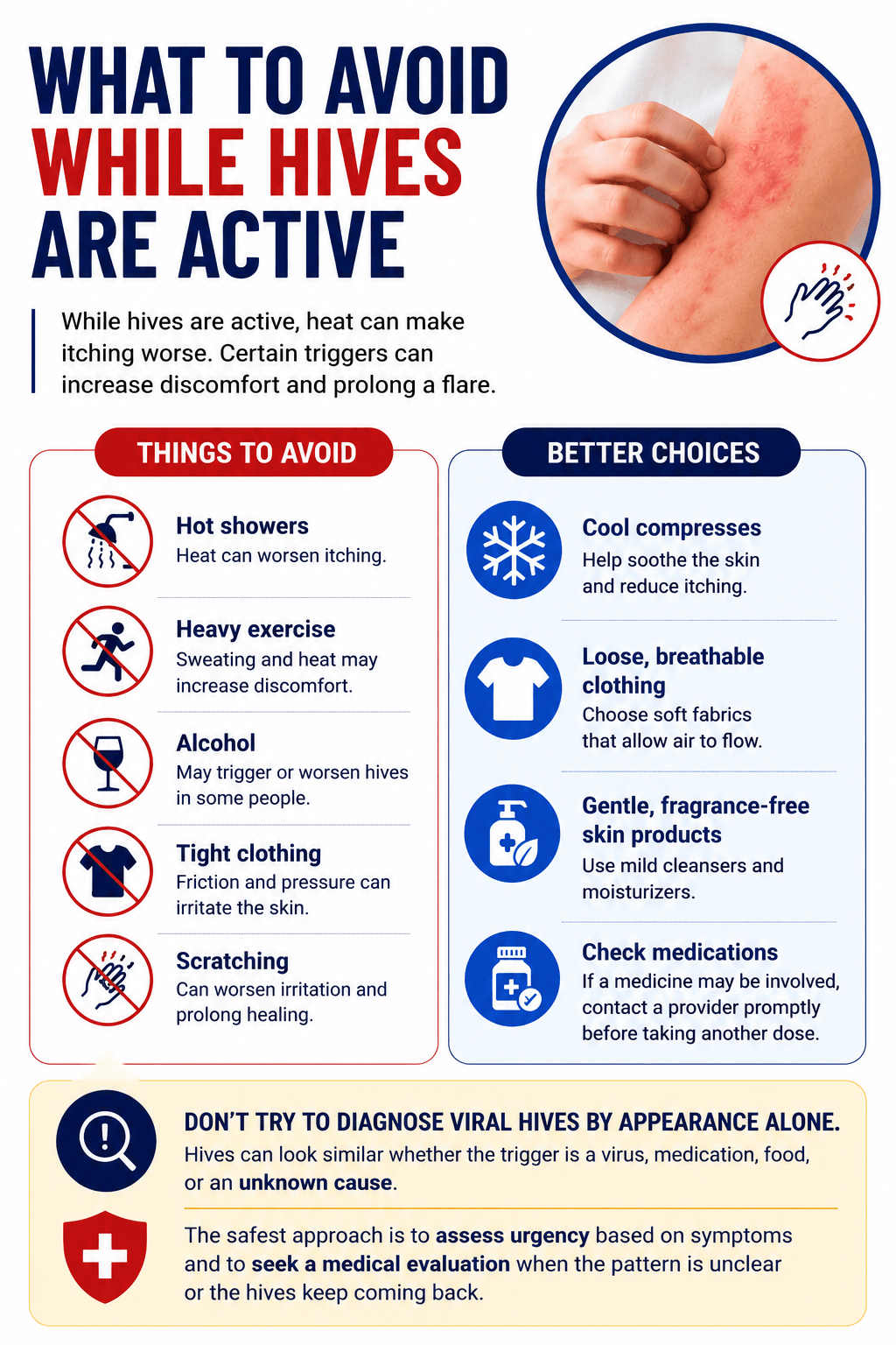 What To Avoid While Hives Are Active